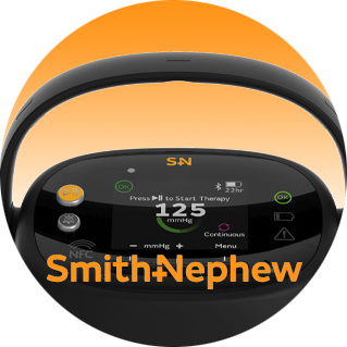 InfuSystem Announces Agreement with Smith+Nephew to Distribute Its RENASYS◊ EDGE NPWT System and Supplies for In Home-Based Care