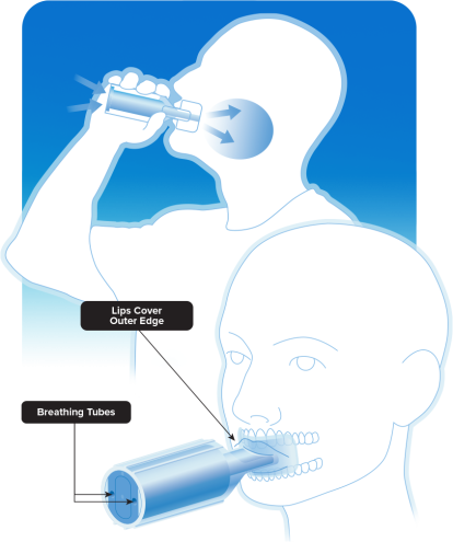 Visual guide detailing the proper method for using the Chemo Mouthpiece at home or at the clinic during and after infusion.