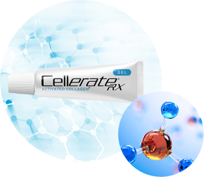 Tube of CellerateRX® Gel Indications for partial and full-thickness wounds, surgical wounds, pressure injuries I-IV, traumatic wounds, venous stasis ulcers, first- and second-degree burns, arterial ulcers, superficial wounds and diabetic ulcers, with a microbial image next to it